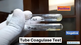 Tube Coagulase Test Positive and Negative Demonstration [upl. by Natrav861]