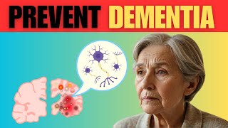 The Early Signs of Dementia and How to Prevent It [upl. by Sirroned]