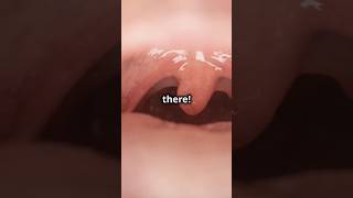 What is the use of tonsil tonsil science facts viralshort youtubeshorts history [upl. by Sneed]