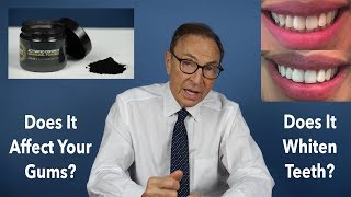 Benefits amp Risks of Activated Charcoal to Whiten Teeth Doctors Advice [upl. by Noremac]