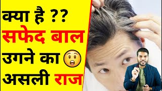 क्या है सफेद बाल उगने का असली राज😲 A2 Motivation [upl. by Cammie]