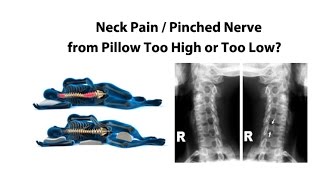 Neck Pain  Pinched Nerve from Pillow Too High or Too Low  Dr Mandell [upl. by Ariella261]