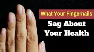 What Your Fingernails Say About Your Health [upl. by Mitchael]