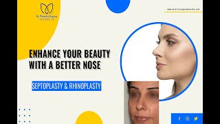 Closed Rhinoplasty amp Septoplasty  Rhinoplasty Before and After  Rhinoplasty Surgery Animation [upl. by Natassia]