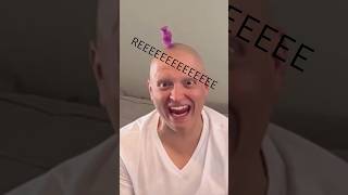 DRIVEBY 🚗 BALD SHOTS❌🥚👨🏽‍🦲 comedy funny alopecia mcsquared90 [upl. by Marillin941]