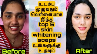 Top 5 skin whitening soaps for full body whitening get 3 to 4 shades lighter skin✨ [upl. by Grof]