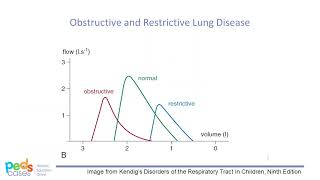 Approach to Spirometry [upl. by Donica]