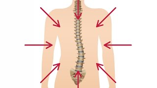 Transform Your Spine with Simple AtHome Scoliosis Exercises [upl. by Enelram]