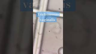 Trichomonas vaginalis motility  Parasitology [upl. by Llirret]