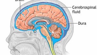 Hydrocephalus  Myelomeningocele  CNS Disorders [upl. by Zelde]