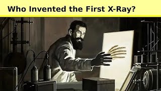 quotXRay का आविष्कार Who Invented It and How  हिंदी में जानें पूरी कहानीquot [upl. by Kubiak450]