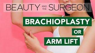 Arm Lift or Brachioplasty  Beauty and the Surgeon Episode 47 [upl. by Gruver]