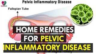 Home Remedies for Pelvic Inflammatory Disease  Healh Sutra [upl. by Paolina]