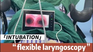 Flexible Laryngoscopy intubation Procedure with BESDATA Disposable Flexible Laryngoscope [upl. by Danais]