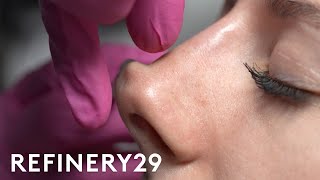 I Tried A NonSurgical Nose Job  Macro Beauty  Refinery29 [upl. by Jeb]