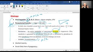 Acute l Fulminant l hepatic failure FHF [upl. by Rebmat311]