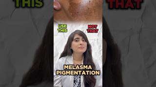 How to treat Melasma  Melasma treatment by dermatologist  Pigmentation  Pigmentation on face [upl. by Faux]