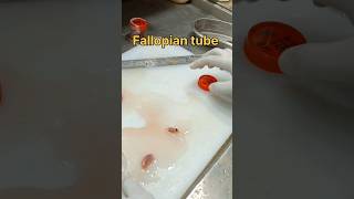 Fallopian tube biopsy sample tissuefixation tissuepreparation biopsy pathology [upl. by Doughty]