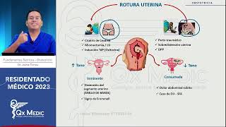 Obstetricia  10 Hemorragia obstetrica II mitad [upl. by Annaicul214]