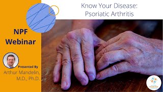 Know Your Disease Psoriatic Arthritis [upl. by Clarita]