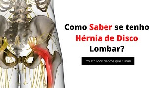 Como Saber se tenho Hérnia de Disco Lombar LIVE 01 [upl. by Cirderf]