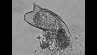 Hatching of a Schistosoma Mansoni Miracidium [upl. by Pope]