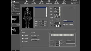 Lecture  Anatomically Programmed Technique amp Radiographic Technique Charts  Radiographic Physics [upl. by Notlih786]