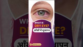 What is DRY EYE [upl. by Eizzil]