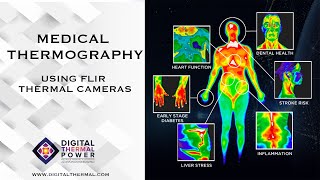 Medical Thermography using FLIR Thermal Camera [upl. by Vasyuta]