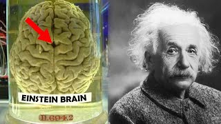 How Einsteins Brain was Different [upl. by Eerej]