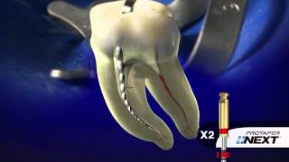 PROTAPER NEXT® Clinical with Dr Ruddle  Dentsply Sirona [upl. by Modern92]