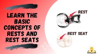 Rests and Rest Seats  The Basics  Removable Partial Denture RPD [upl. by Mcmath525]