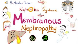 Membranous Nephropathy  Nephrotic Syndrome  5Minute Review Series [upl. by Merrielle]