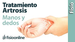 Tratamiento de fisioterapia para la artrosis de manos y dedos [upl. by Belmonte]