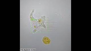 Amoeba Movement  kingdom protista Amoeba unicellular science artistic microscope research [upl. by Muna594]