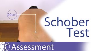 Schober Test for Lumbar Spine Flexion [upl. by Aneras58]