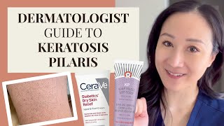 Dermatologist Guide to KP  Keratosis Pilaris Chicken Skin [upl. by Dreher]