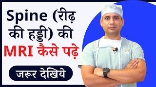 how to read spine mri at home  Dr naveen ne samjhaya scitica me mri kaise pata chalta hai [upl. by Season]