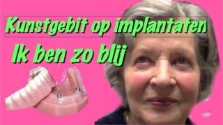 Kunstgebit op implantatenhet klikgebit gemaakt in Amsterdam Zuidoost [upl. by Anayet911]