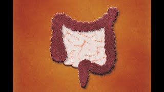 Patología Isquémica Intestinal Definición Evaluación Tratamiento [upl. by Ailaro753]