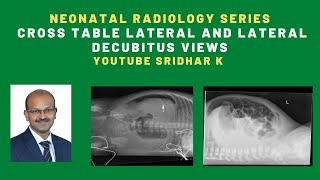 Neonatal radiology serieswhen do we use cross table lateral view and lateral decubitus view xray [upl. by Monetta24]