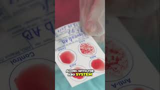 Human Rh Blood Factor Type Explained health hospital sickness diseases [upl. by Mabel]