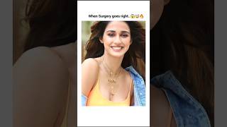 When surgery goes right😱🤯🔥 Disha Patani Plastic surgery Transformation🔥youtubeshorts bollywood [upl. by Crescentia]