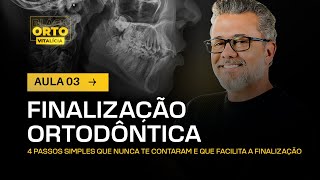 Aula 39  Finalização Ortodôntica [upl. by Ivets]