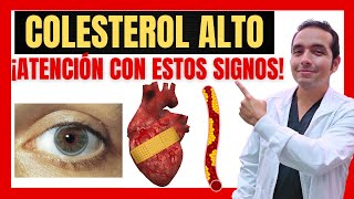 🔴 SIGNOS Y SÍNTOMAS DE COLESTEROL ALTO 🧈🍔🍟 [upl. by Nibla502]