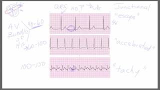 Junctional Rhythms [upl. by Amr956]