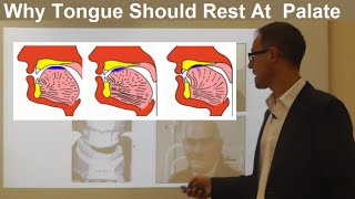 Should Tongue Rest Touch at the Palate Maxilla Roof of the Mouth By Dr Mike Mew [upl. by Ayital403]