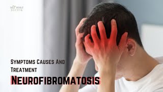 Neurofibromatosis Types Symptoms Causes and Treatment [upl. by Nadya]