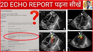 2D ECHO REPORT कैसे पढ़ते हैं2D ECHO REPORT मैं क्या क्या लिखा होता है2D ECHO दिल की जांच रिपोर्ट [upl. by Getter]