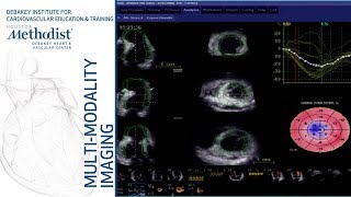 Principles of Echo Doppler William A Zoghbi MD September 18 2018 [upl. by Musa249]